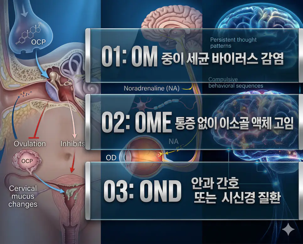의학용어 OM, OME, OND의 정의와 중이 세균 바이러스 감염, 통증 없이 이소골 액체 고임, 안과 간호 또는 시신경 질환의 핵심 특징을 영화 포스터 스타일로 정리한 프리미엄 인포그래픽